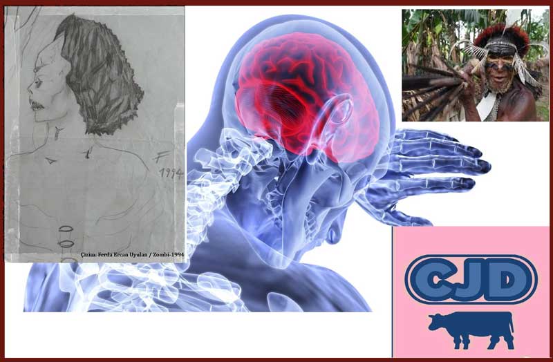 İnsan eti yiyenlerin laneti ''Kuru hastalığı'', ''Deli dana'' ve olası Zombi'ler